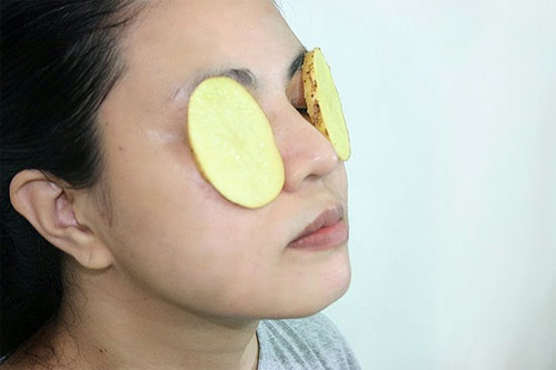 Dùng khoai tây đắp lên mắt sưng